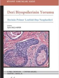 Deri Biyopsilerinin Yorumu