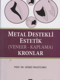Metal Destekli Estetik (Veneer - Kaplama) Kronlar