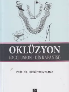 Oklüzyon